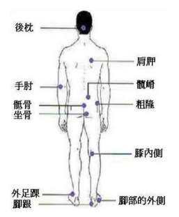 後枕, 肩胛, 手肘, 髖嵴, 骶骨, 坐骨, 粗隆, 膝內側, 外足踝腳跟, 腳部的外側